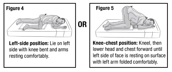 Prepare the patient for administration by requesting
they empty their bladder and bowel, if possible - Illustration